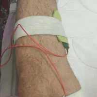 فیزیوتراپی در مطب و منزل