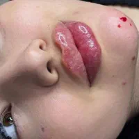فیلر چانه گونه کانتورینگ زاویه ژل لب بوتاکس شیدینگ|خدمات آرایشگری و زیبایی|فردیس, |دیوار