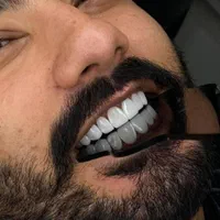 ارتودنسی.ایمپلنت.روکش.عصب کشی|خدمات آرایشگری و زیبایی|تهران, هروی|دیوار