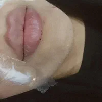 تخفیف ویژه پی ار پیprpفیلرژل بوتاکس کامپوزیت|خدمات آرایشگری و زیبایی|اهواز, کیان اباد|دیوار