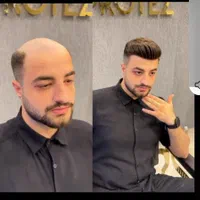 پروتز مو ، چسب پروتز ، ترمیم و تعویض چسب|خدمات آرایشگری و زیبایی|تبریز, |دیوار