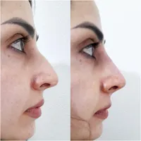 دوره جامع آموزش تزریق ژل،بوتاکس،لیفت نخ وفیلربادی|خدمات آموزشی|شاهین‌شهر, فردوسی|دیوار