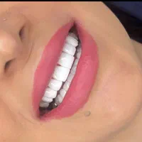 خدمات دندانپزشکی کامپوزیت دندان|خدمات آرایشگری و زیبایی|اسلام‌شهر, باغ فیض|دیوار