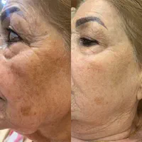 فیشیال و آبرسانی تخصصی/ خدمات و آموزش|خدمات آرایشگری و زیبایی|کرج, فاز ۲ مهرشهر|دیوار