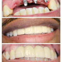 مطب دندانپزشکی واقع در مرکز شهر (نادری )|خدمات آرایشگری و زیبایی|اهواز, نادری|دیوار