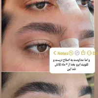 اصلاح تخصصی ابروهای نامتقارن
