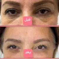 آفر فر مو، پروتئینه،لیفت و لمینت مژه ابرو،مژه موقت|خدمات آرایشگری و زیبایی|تهران, بهار|دیوار