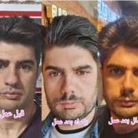 عمل جراحی بینی بامتخصص گوش،حلق،بینی|خدمات آرایشگری و زیبایی|تهران, ونک|دیوار