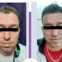 کاشت مو پرتراکم اقساطی با پرداخت 4میلیون تومان|خدمات آرایشگری و زیبایی|اصفهان, میرعماد|دیوار