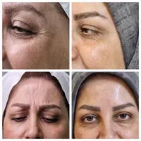 منشی مطب پوست و مو و لیزر ویژه بانوان /پاره وقت|استخدام درمانی، زیبایی، بهداشتی|تهران, قنات‌کوثر|دیوار