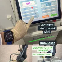 دستگاه co2 فرکشنال ایکس ماتریکس|پزشکی|تهران, فاطمی|دیوار