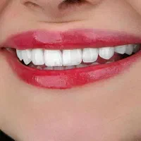 دندانپزشکی دکتر محمد ناصری|خدمات آرایشگری و زیبایی|کرمانشاه, |دیوار