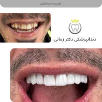 کامپوزیت و لمینت دیجیتال دندان با اقساط بلندمدت|خدمات آرایشگری و زیبایی|تهران, امیریه|دیوار