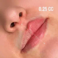 تزریق ژل لب و بوتاکس تضمینی|خدمات آرایشگری و زیبایی|تهران, خانی‌آباد|دیوار