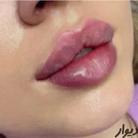 آموزش کوچک کردن بینی فیلرژل و بوتاکس آنزیم|خدمات آرایشگری و زیبایی|مشهد, آزادشهر|دیوار