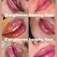 ژل و بوتاکس و آرایش دایم|خدمات آرایشگری و زیبایی|میبد, |دیوار