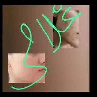 کرم معجزه ونوس لایف غلامی|آرایشی، بهداشتی، درمانی|شیراز, شیخ علی چوپان|دیوار