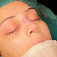 خدمات عمل جراحی زیبایی بینی و ترمیم بینی|خدمات آرایشگری و زیبایی|تهران, فلاح|دیوار