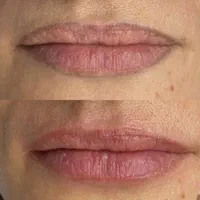 ریموو تخصصی پاک کردن تتو ابرو و خط چشم تضمینی|خدمات آرایشگری و زیبایی|بروجرد, |دیوار