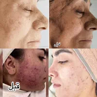فیشیال تخصصی پوست