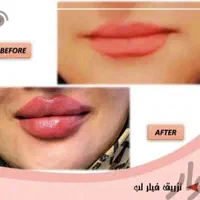 مرکز زیبایی دکتر تقوی|خدمات آرایشگری و زیبایی|یاسوج, |دیوار