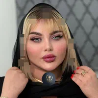 تزریق ژل و بوتاکس و مادلینگ خلیجی و هایفو درکلینیک