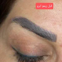 ریمووانواع تتوهای بدن،لب،وچشم ،ابرو|خدمات آرایشگری و زیبایی|رشت, حمیدیان|دیوار