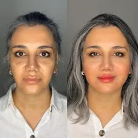 مدل روسی هایفو نخ کلینیک پوست بدون رقیب واقعی|خدمات آرایشگری و زیبایی|تهران, زعفرانیه|دیوار
