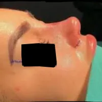 جراحی زیبایی بینی (جشواره)|خدمات آرایشگری و زیبایی|تهران, صادقیه|دیوار