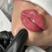جشنواره لب فیلر ژل روسی بوتاکس زاویه سازی مادلینگ|خدمات آرایشگری و زیبایی|کرج, گوهردشت|دیوار