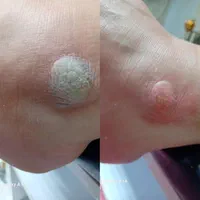 پدیکور تخصوصی درمان ترک کف پا|خدمات آرایشگری و زیبایی|مشهد, امام خمینی|دیوار