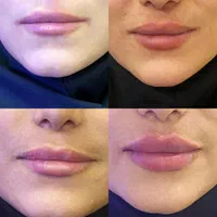 تخفیف ویژه کلینیک مویان