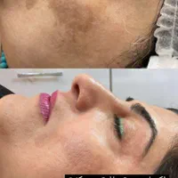 ۵۰ درصد تخفیف ویژه فیشال به مدت ۳ روز|خدمات آرایشگری و زیبایی|اهواز, کیانپارس |دیوار