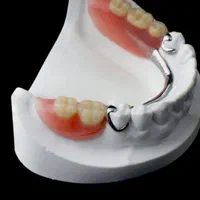 دست دندان طرح لمینیت|خدمات آرایشگری و زیبایی|تهران, مهران (سیدخندان)|دیوار