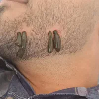 امبدینگ بادکش حجامت طب سوزنی فصد خون زگیل تناسلی|خدمات آرایشگری و زیبایی|اصفهان, باغ زرشک|دیوار