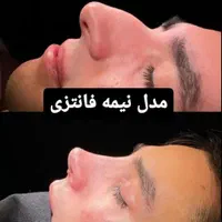عمل بینی.لیفت|خدمات آرایشگری و زیبایی|کرج, کرج نو|دیوار