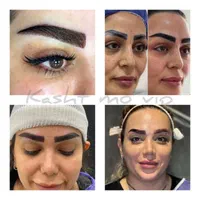 کاشت تخصصی مو و ابرو با بالاترین کیفیت|خدمات آرایشگری و زیبایی|مشهد, امام خمینی|دیوار