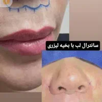 اقساط -کلینیک جراحی زیبایی دکتر محمدی مقام-اقساط|خدمات آرایشگری و زیبایی|اهواز, کوروش|دیوار