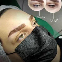 جذب مدل به مدت محدود برای تکنیک فیبروز و دکاپاژ