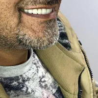 ساخت دندان مصنوعی تحویل یک روزه|خدمات آرایشگری و زیبایی|قم, بکایی|دیوار