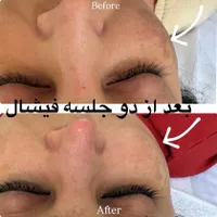 پاکسازی و فیشال تخصصی مشاوره رایگان|خدمات آرایشگری و زیبایی|تهران, حکمت|دیوار