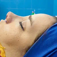 جشنواره جراحی بینی پلک ابدو بلفارو گوش|خدمات آرایشگری و زیبایی|قم, سالاریه|دیوار