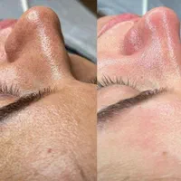 فیشال تخصصی