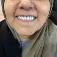 ساخت انواع دندان مصنوعی + لابراتوار دندانساری|خدمات آرایشگری و زیبایی|تهران, یافت آباد جنوبی|دیوار