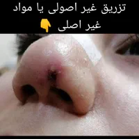 کلینیک ژل آنزیم بینی. لب بوتاکس فیلر و آموزش|خدمات آرایشگری و زیبایی|مشهد, آزادشهر|دیوار