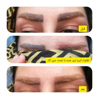 لیزر پاک کردن تاتو کیوسوییچ هایفوفرکشنالco2|خدمات آرایشگری و زیبایی|اهواز, کیانپارس |دیوار