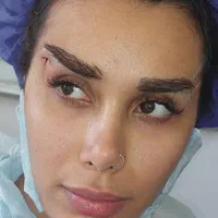 آموزش تخصصی ژل و بوتاکس پی ار پی نخ با مدرک|خدمات آموزشی|تهران, سعادت‌آباد|دیوار