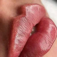 تزریق ژل لب . بوتاکس با ماندگاری بالا لیزر PRP|خدمات آرایشگری و زیبایی|تهران, ستارخان|دیوار