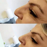 آموزش هیالورون پن کاشتمو آموزشگاه ژل بوتاکس|خدمات آموزشی|تهران, ستارخان|دیوار