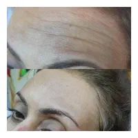 خدمات وآموزش پاکسازی پوست فیشیال فقط ویژه بانوان|خدمات آرایشگری و زیبایی|مشهد, طلاب|دیوار